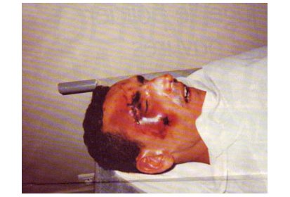 Photo de Mohamed Ali Saoud prise à la morgue par sa famille.